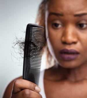 Woman losing hairs on her comb