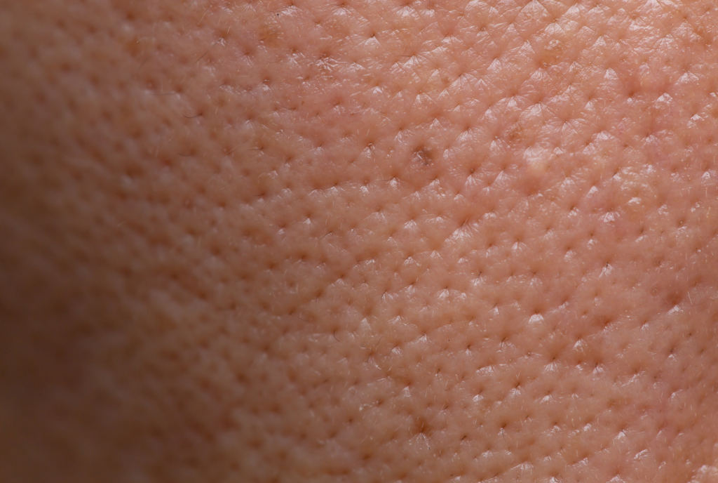 Pores dialtés