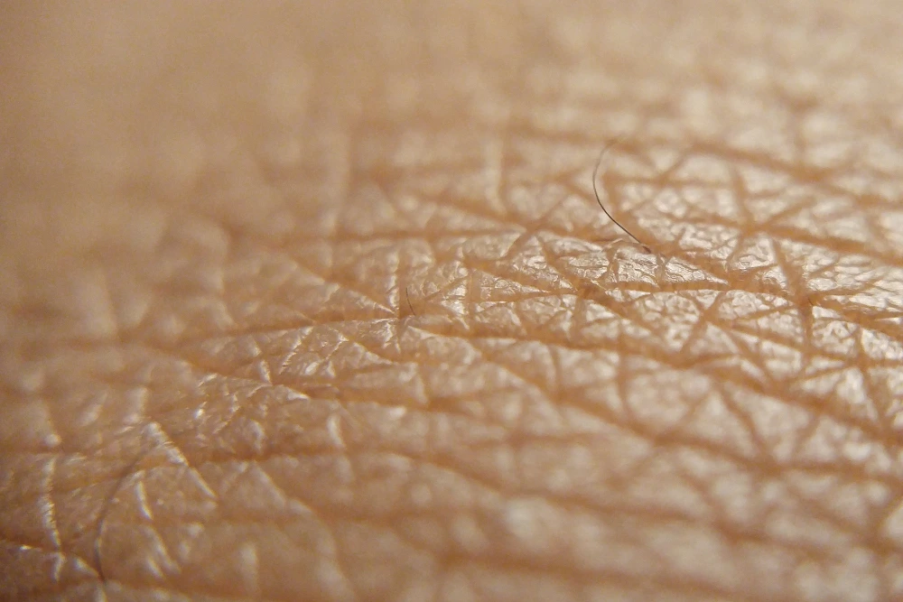 Texture de peau